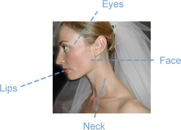 Main areas where wrinkles can appear on the head